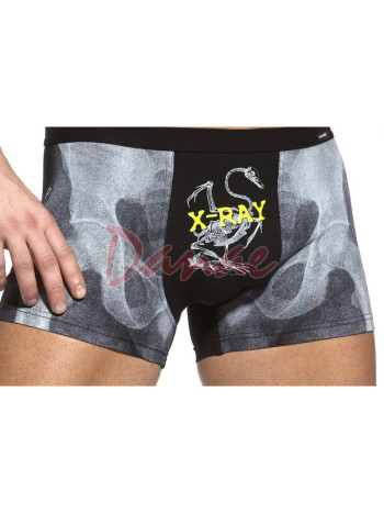 Pánske boxerky s humornou potlačou - X-ray